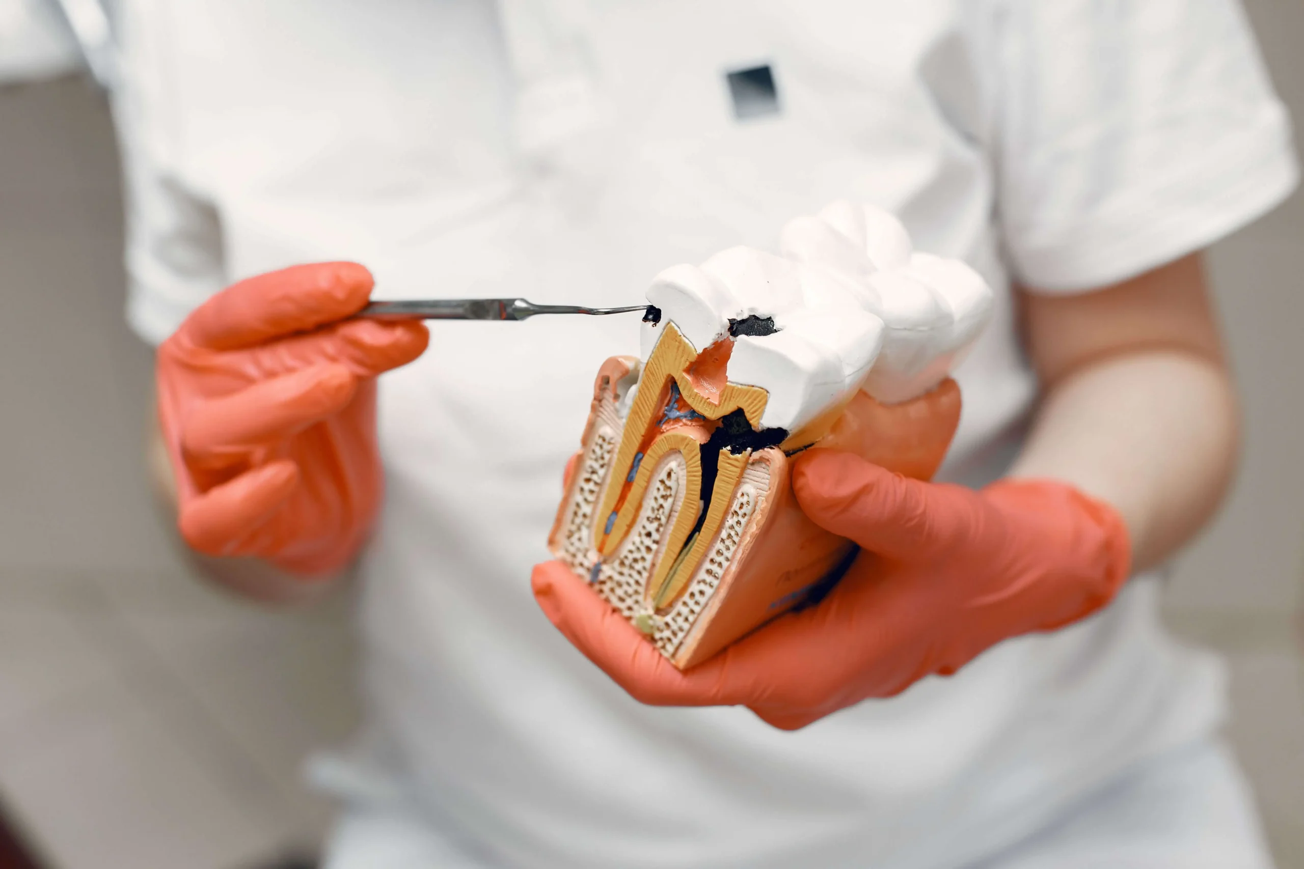 VD Stoma - Endodoncie